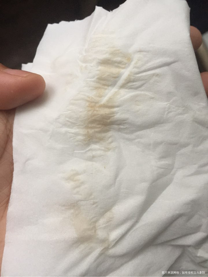 早孕 45天 求助 求助 求助