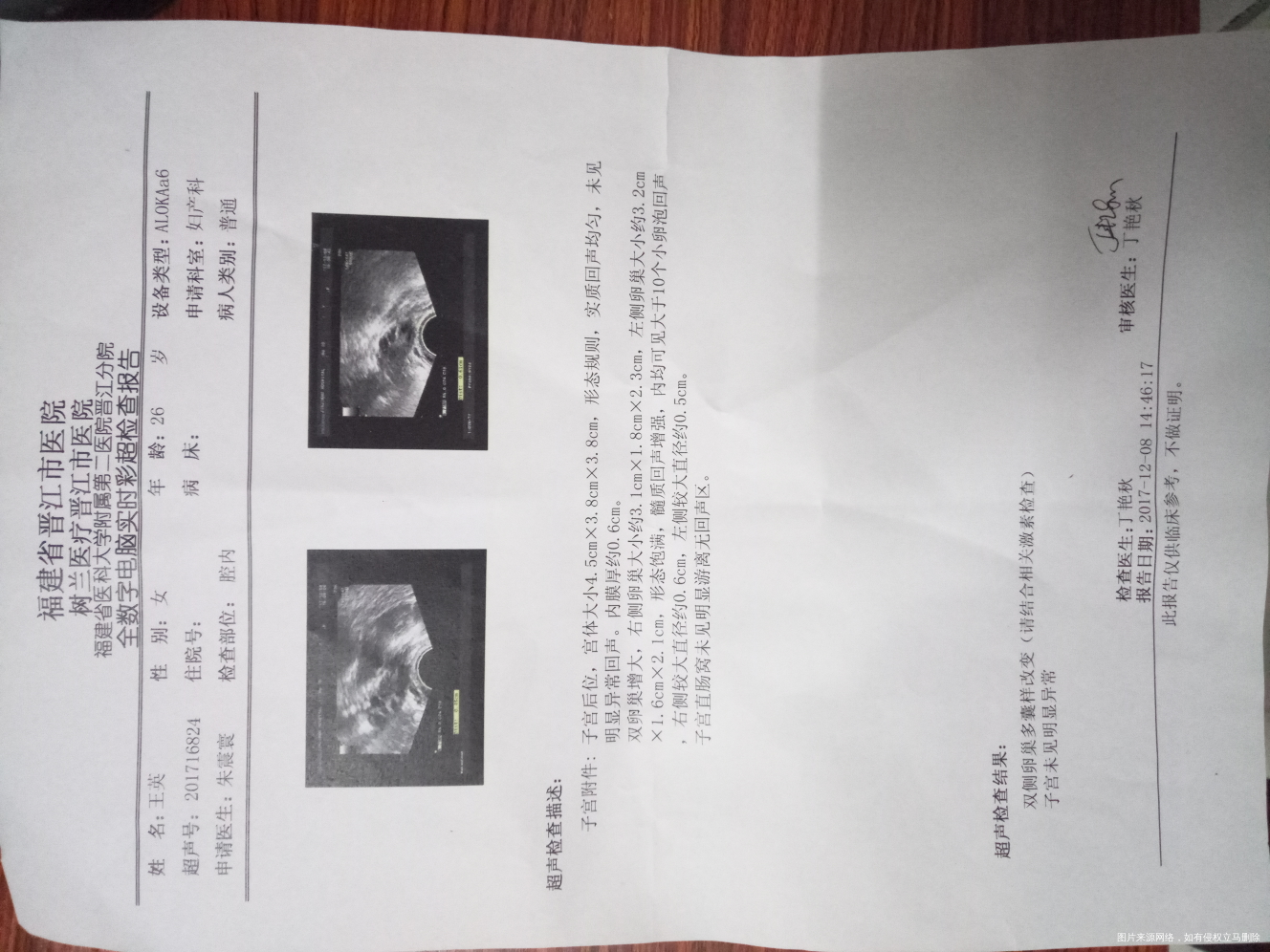 麻烦医生帮忙分析一下彩超报告单