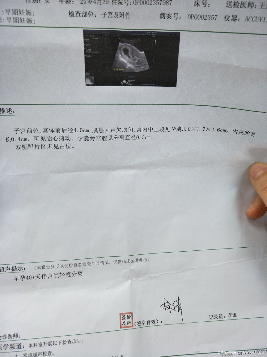 亲问医生我这个b超单还会出现先兆流产情况吗