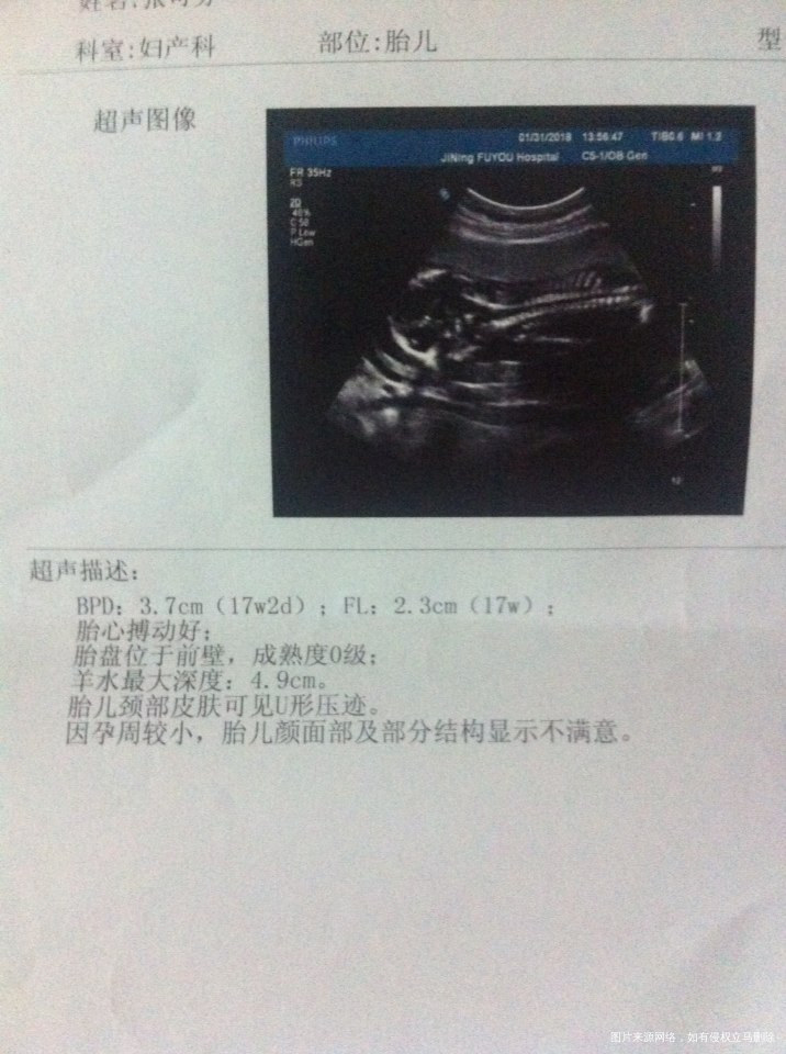 姐妹们看看你们有这种情况吗