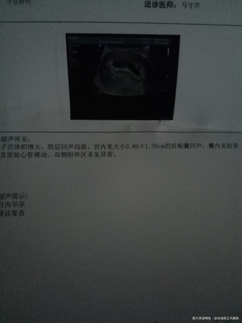 麻烦路过的医生看看这是怀孕7周,正常吗?