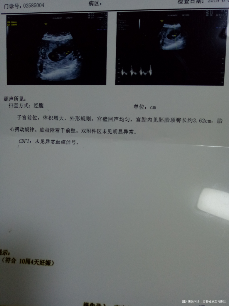 麻烦看看正常吗?谢谢啦