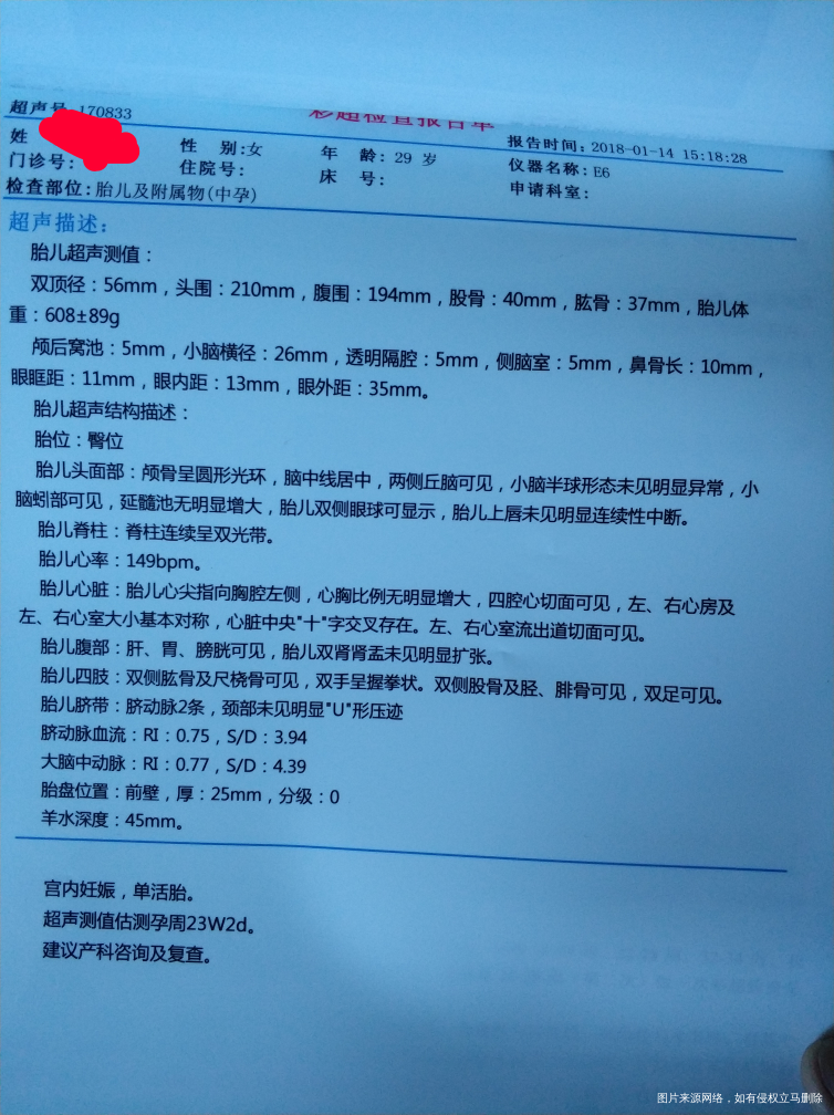 帮忙看看生男生女谢谢了