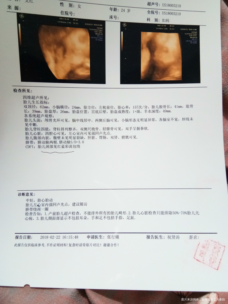 四维心脏有强光点不晓得要不要紧