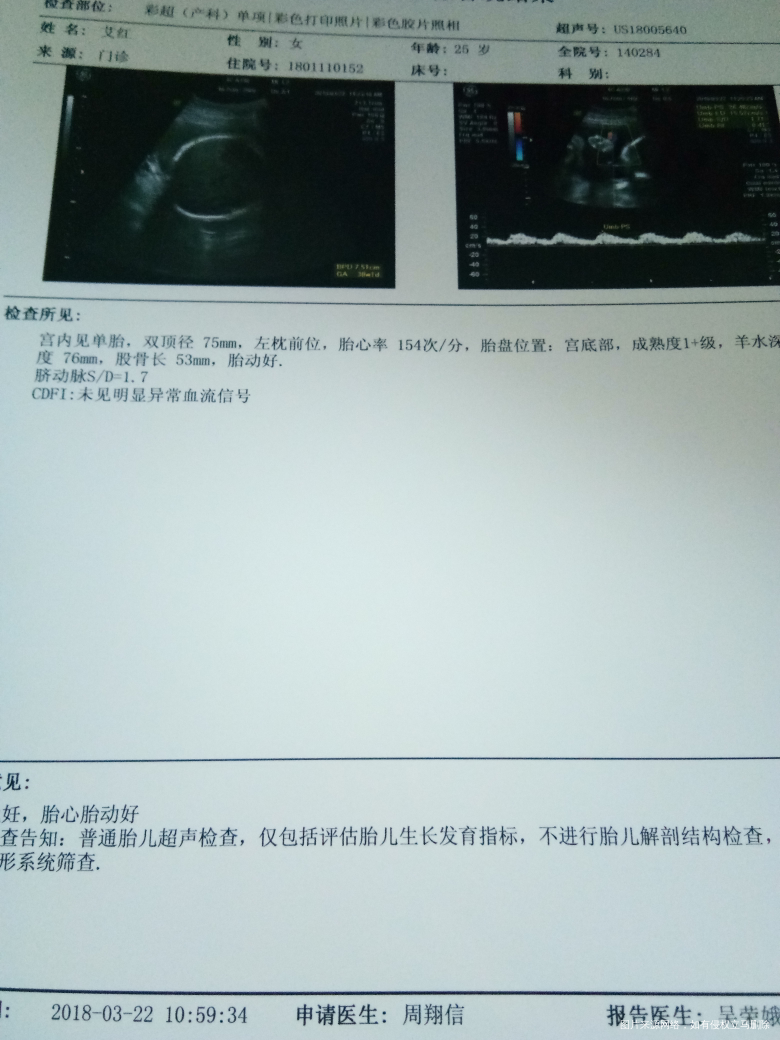 四维心脏有强光点不晓得要不要紧