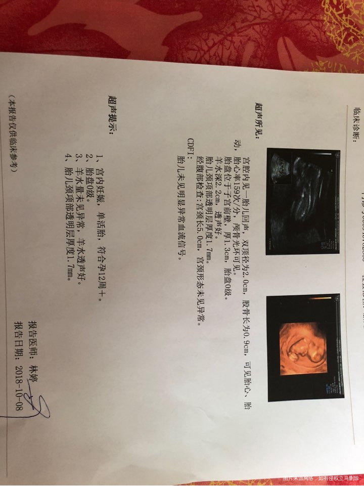 8号NT,这样正常吗?这几天感觉肚子下面走路时有点疼,