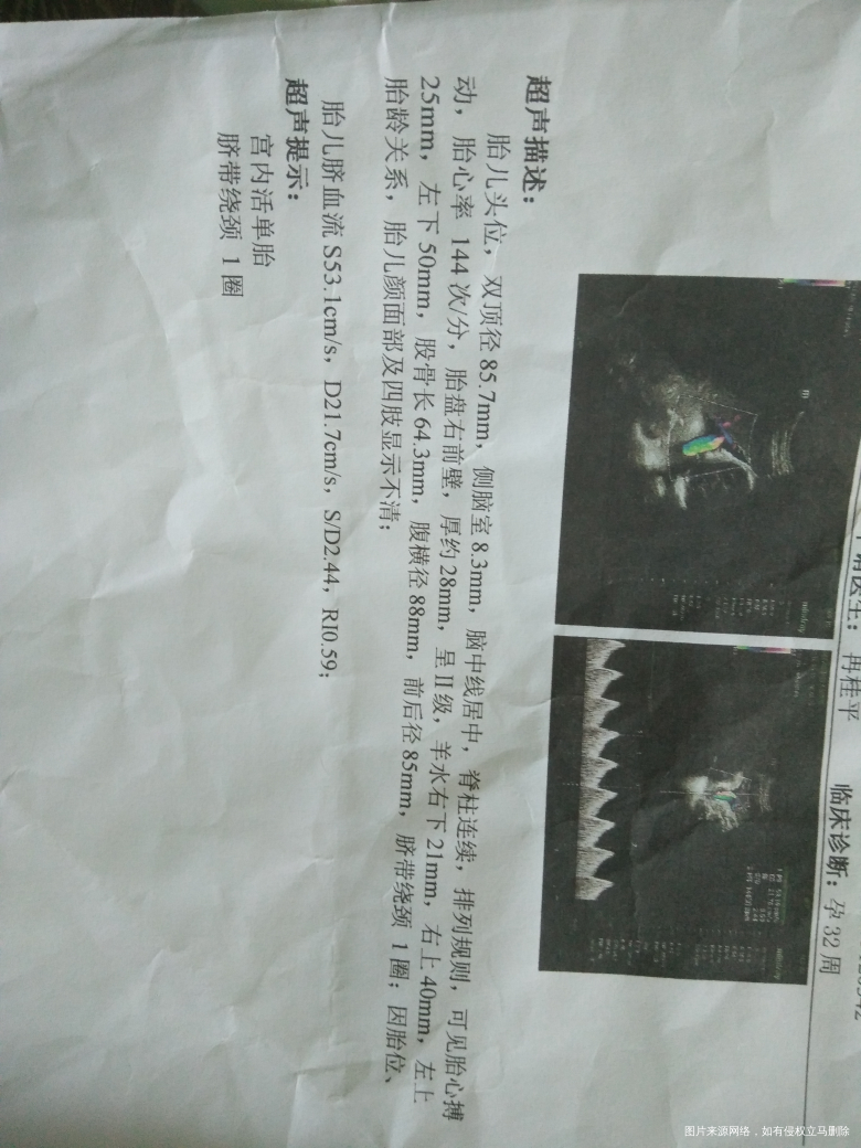 现在怀孕33周+3 会不会涨的太快了