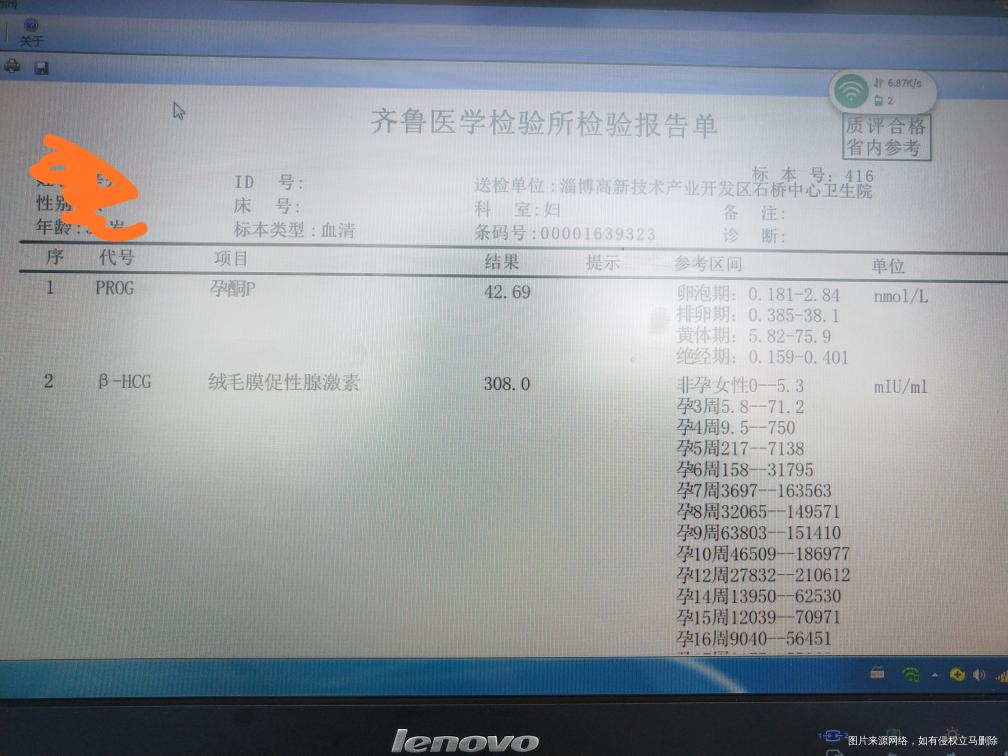 这是昨天查的血
孕4周4天的数值,姐妹们帮我看看