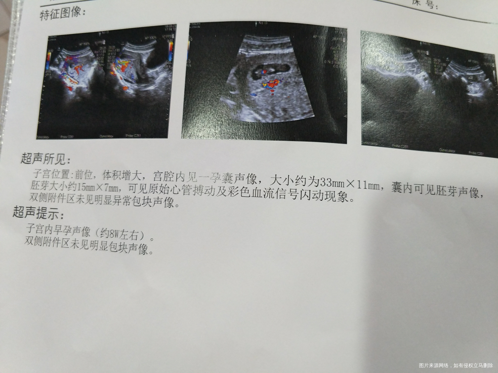 因为有点血状分泌物做了检查