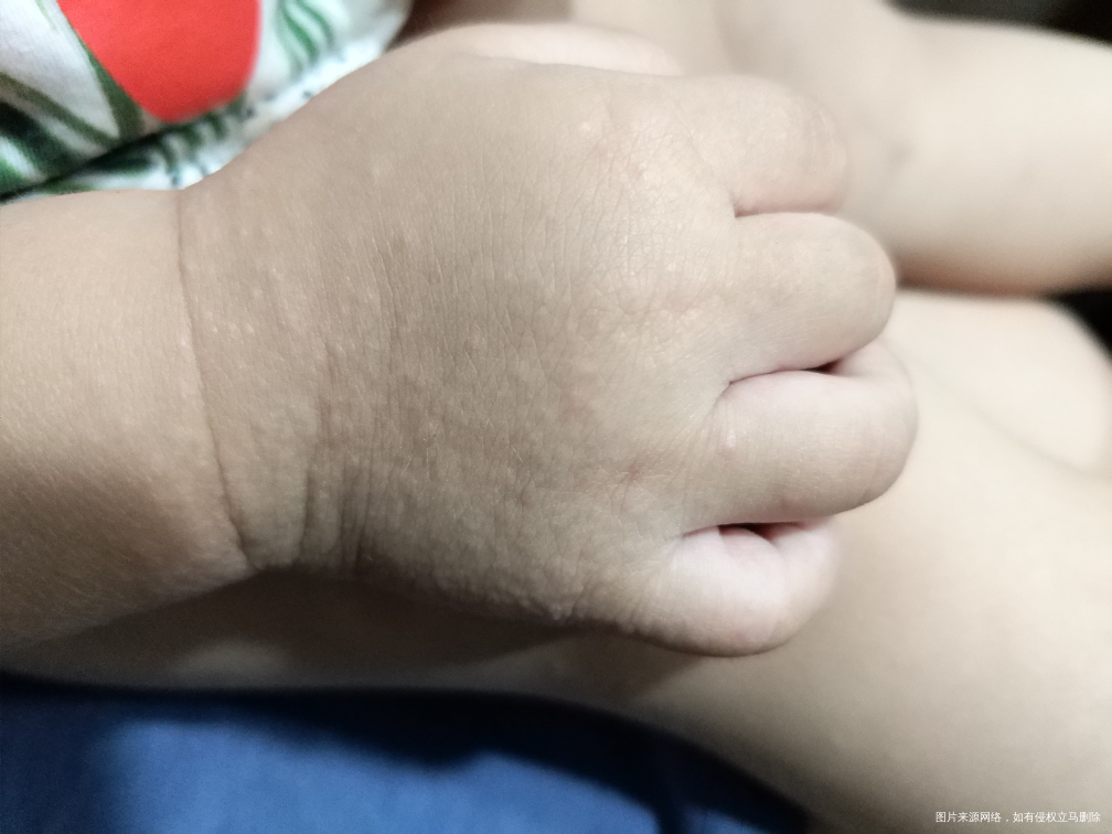 请医生帮我看看孩子这长的什么