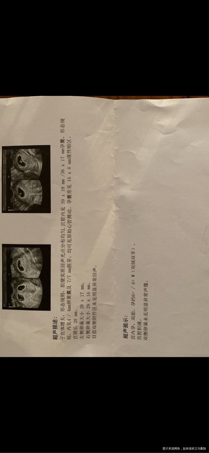 本来明天做一超的 今天夜里凌晨12点突然出血 吓的立马去打了b超 抽hcg和孕酮...