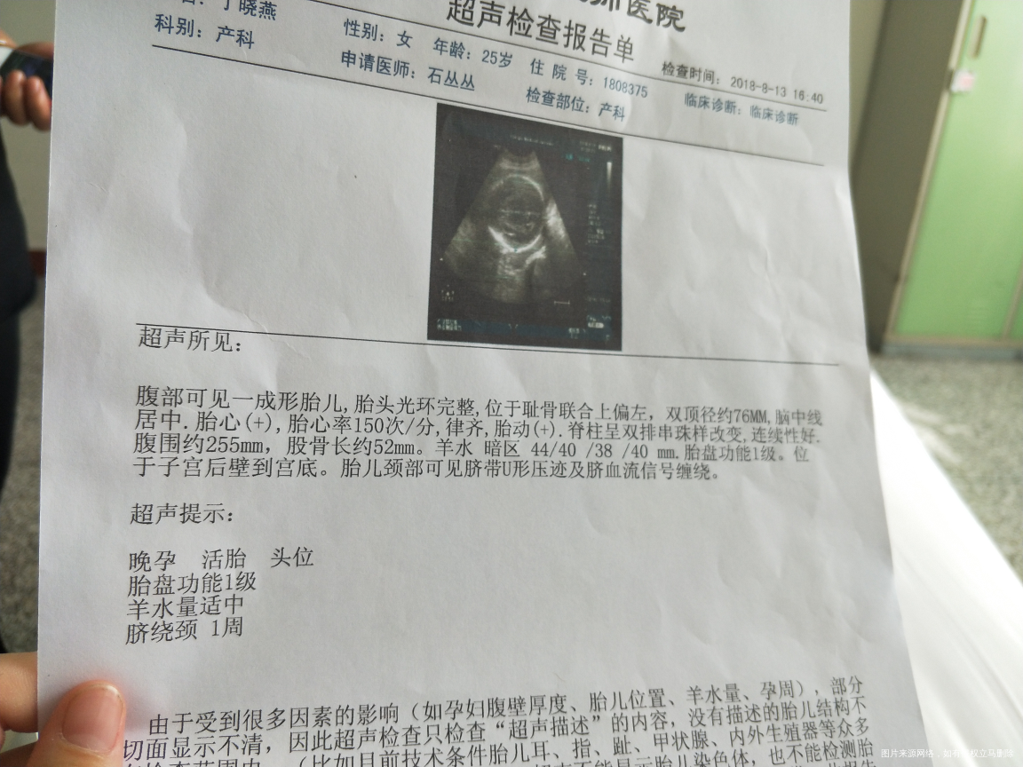 有没有在线的医生帮忙看看