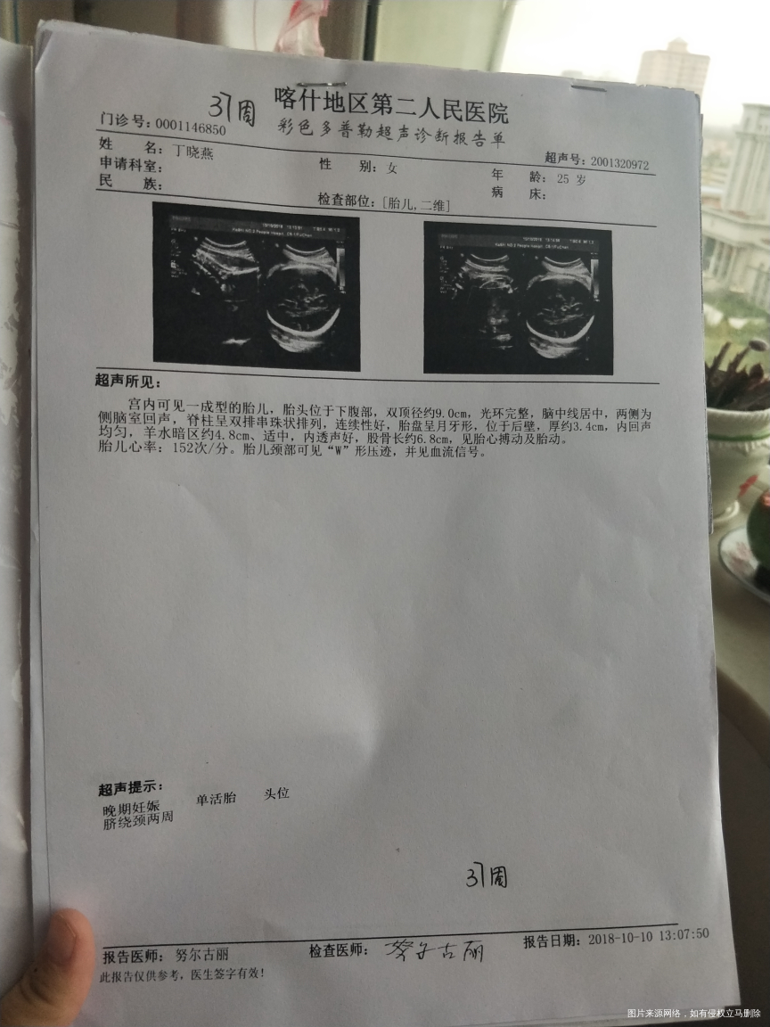 有没有在线的医生帮忙看看