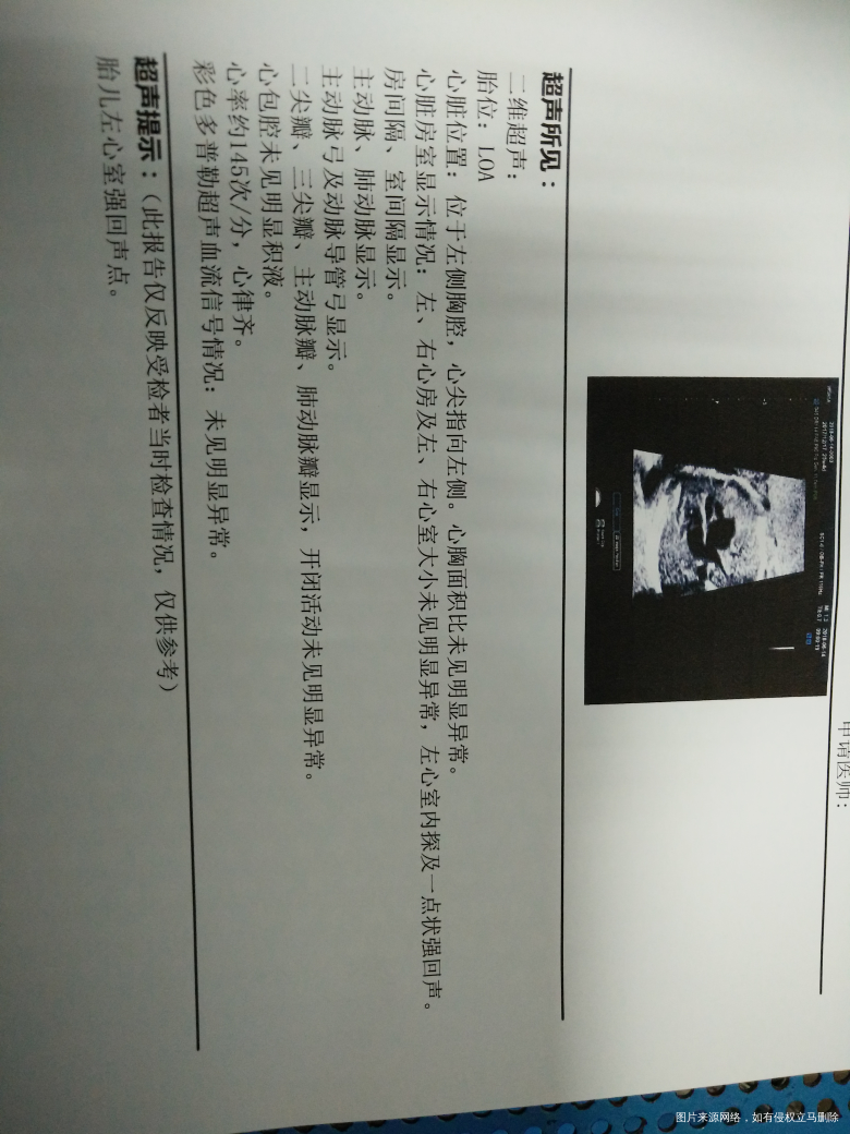 医生,医生,请帮我看看报告