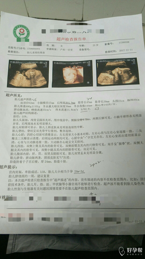 这是上午的四维彩超单子,说是后颅窝池和s/d值不正常,医生帮忙看一下