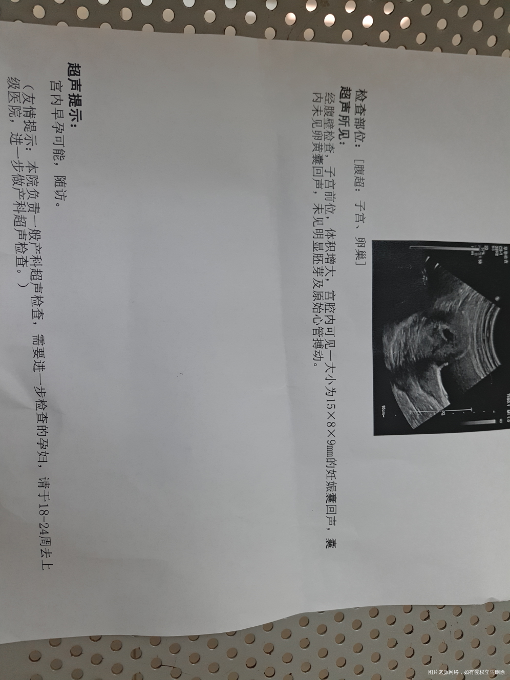 麻烦医生帮忙看下,谢谢