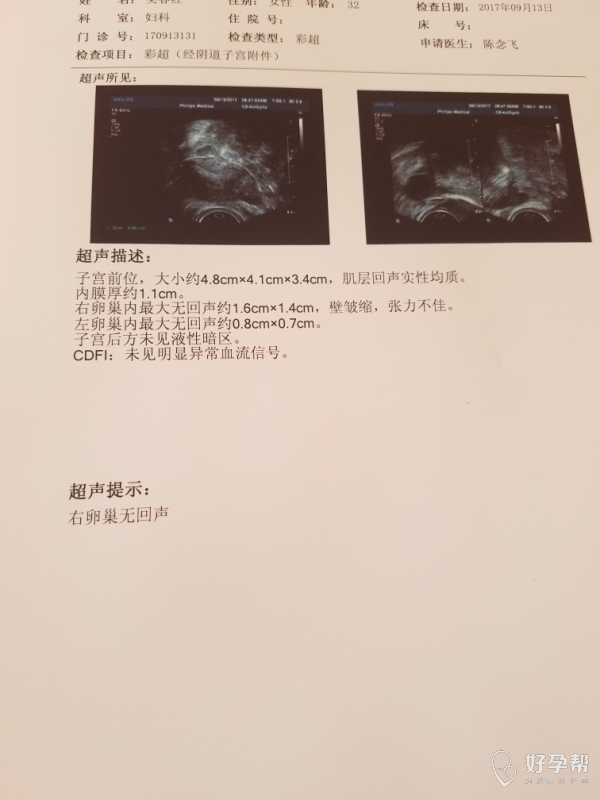 今天做的彩超,医生帮看一下结果,排卵了吗