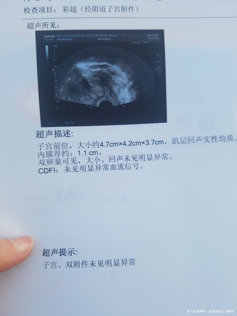 求助医生,麻烦帮我看看检查结果