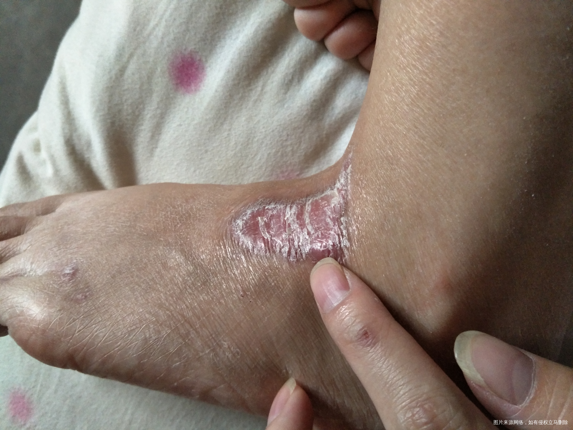 怀孕四个月的时候摔倒擦伤的