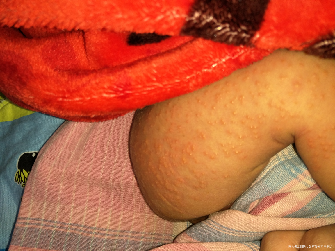 急急急,麻烦看到的医生进来看看