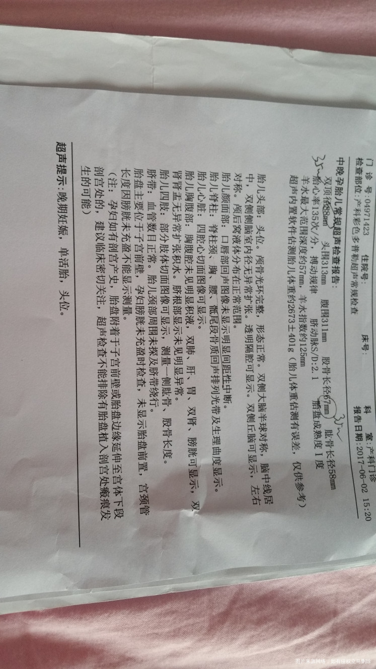 孕34周B超检查单,麻烦医生帮忙看下