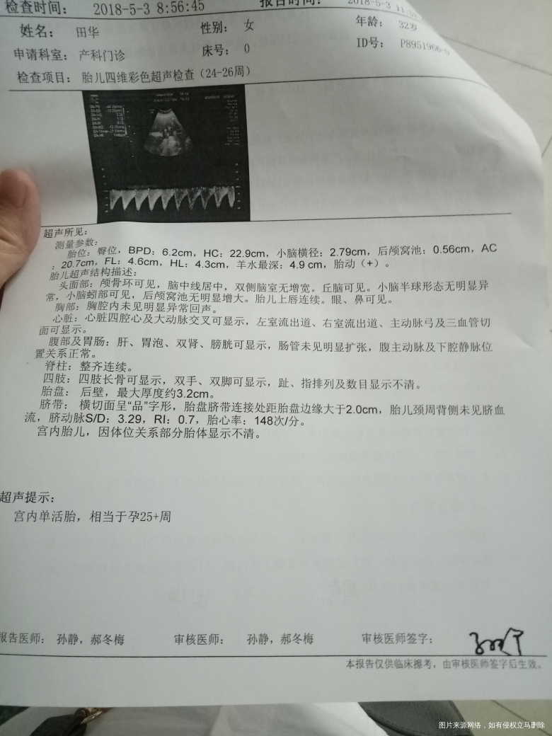 麻烦医生看看没问题吧