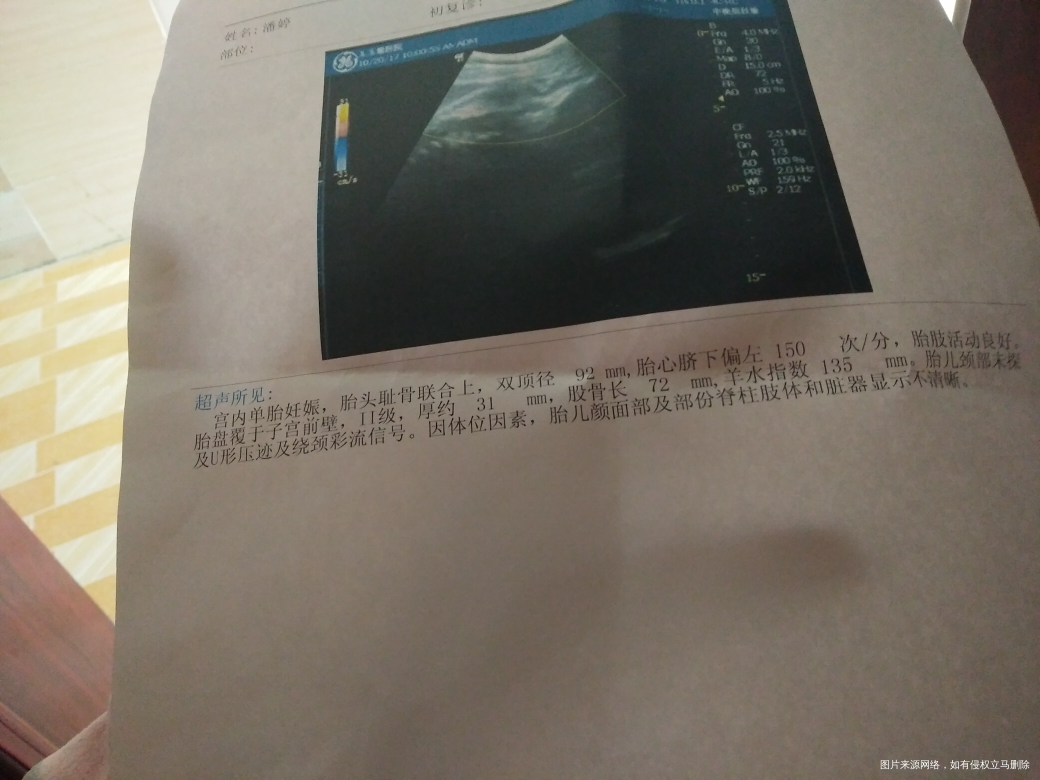 在线的医生帮忙看看都正常吧