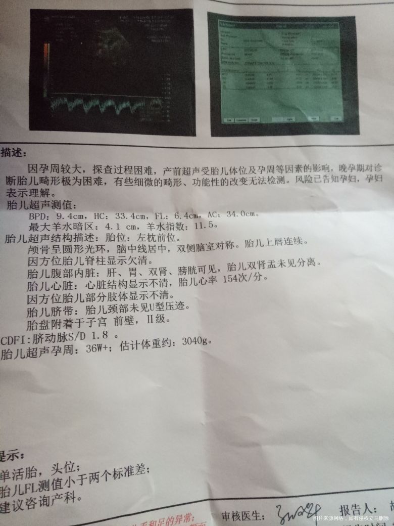 38周彩超说宝宝腿有点短