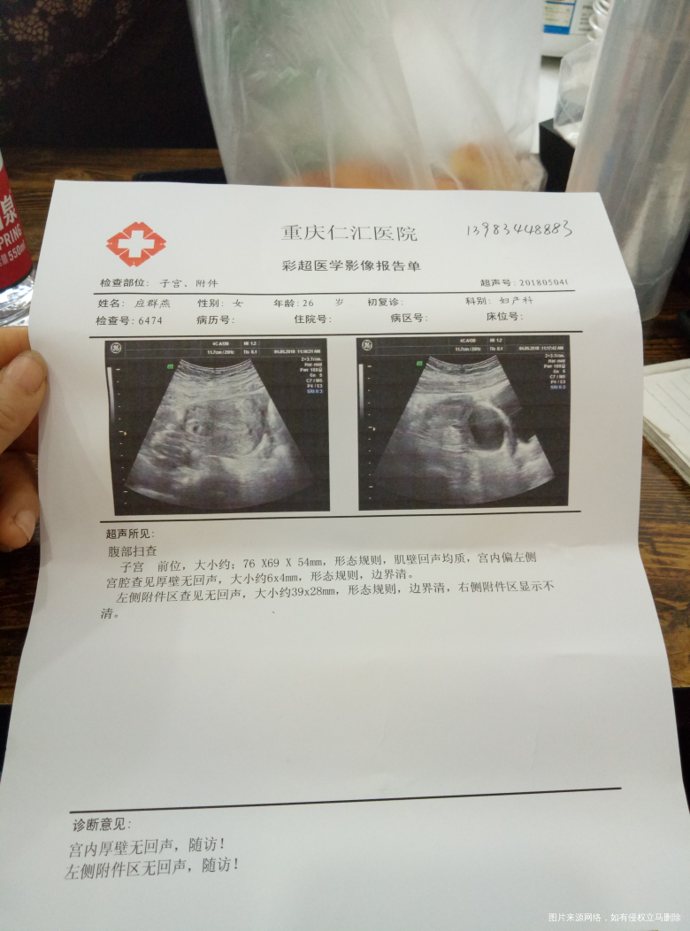 这是我今天去照的彩超,请问有什么问题吗?