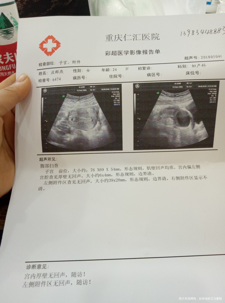 这是我今天去照的彩超,请问有什么问题吗?
