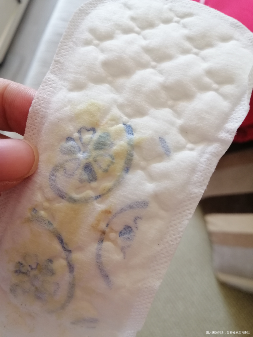 麻烦帮我看下,这是褐色分泌物吗