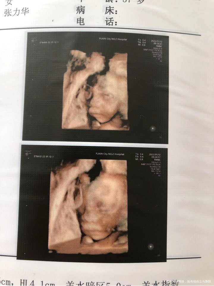 今天做四维一次性通过了。你真棒!不过医生说妈妈太胖了图像不清晰,不过也一次性过了...