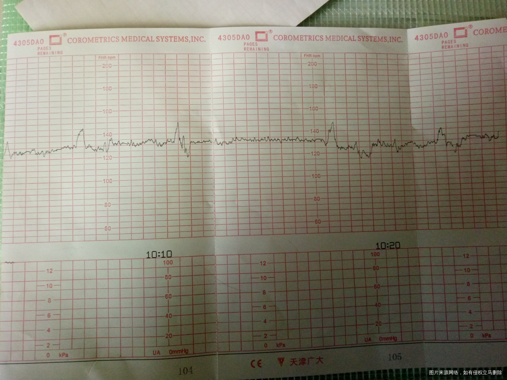 孕36周,胎心监护不太好怎么办