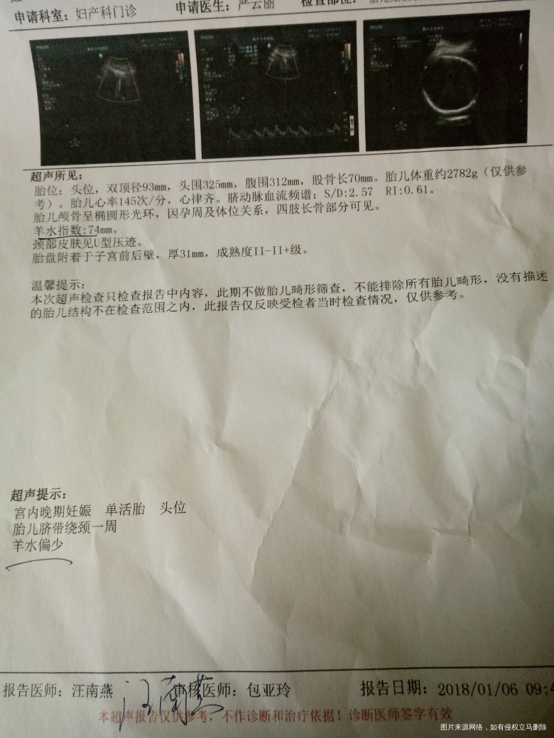 孕36周,胎心监护不太好怎么办