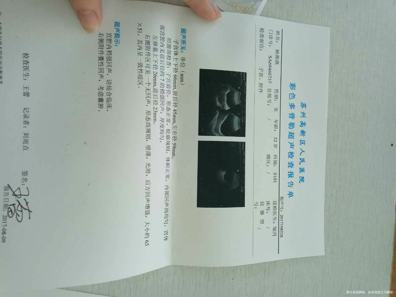 麻烦医生帮忙看看结果