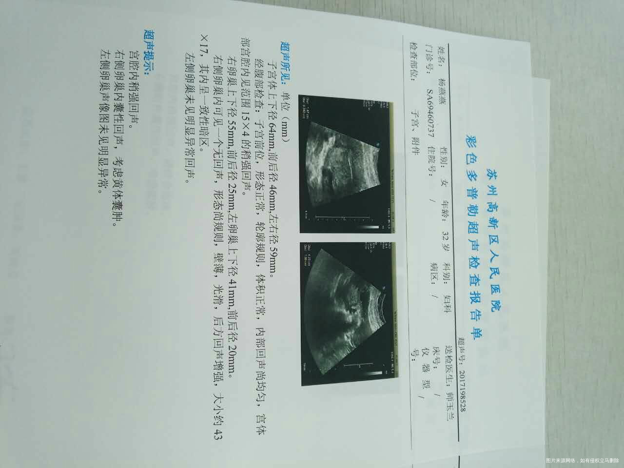 麻烦医生帮忙看看结果