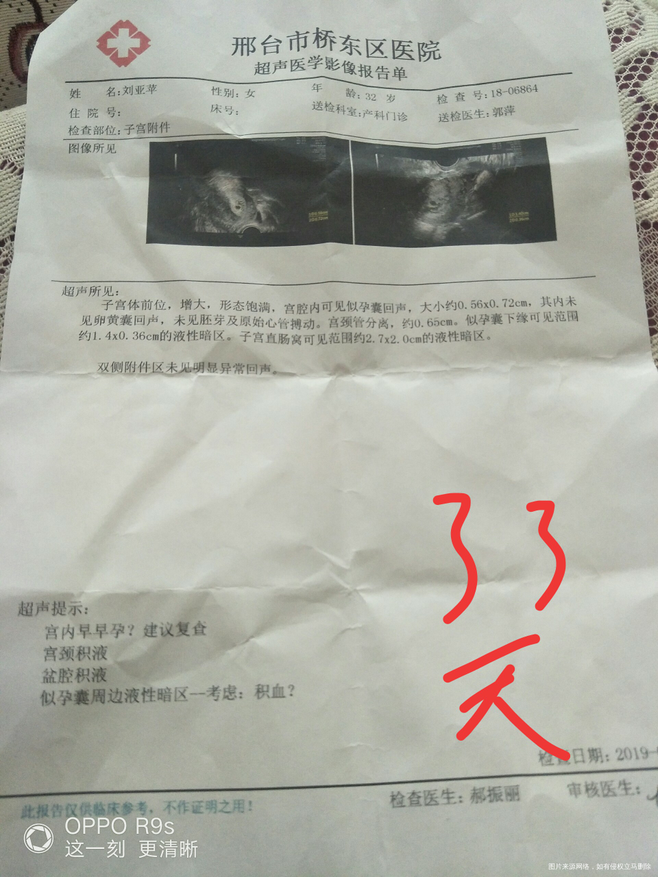 帮我看看,问题大吗,怎么办