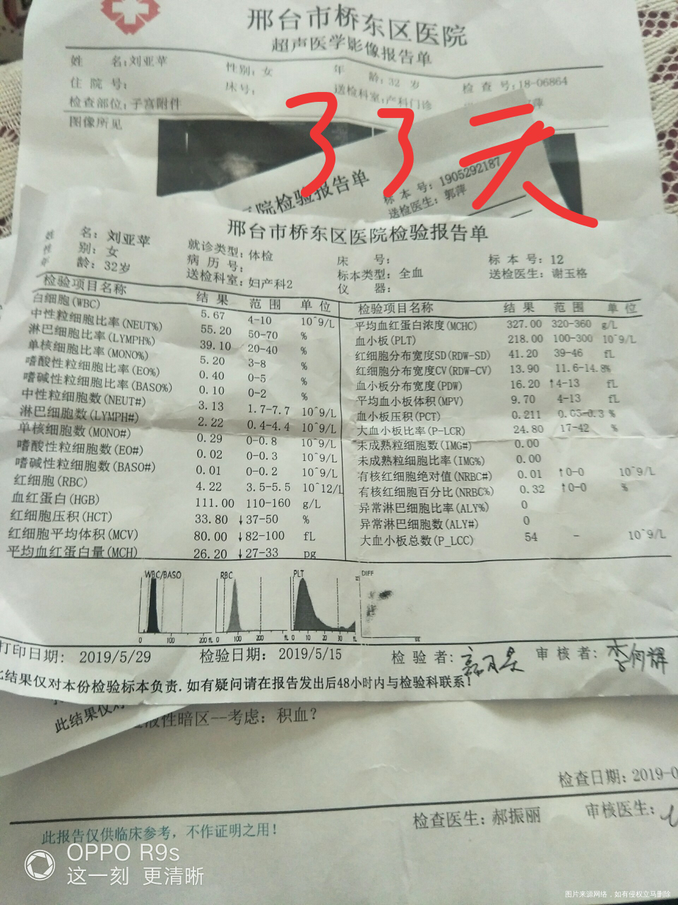 帮我看看,问题大吗,怎么办