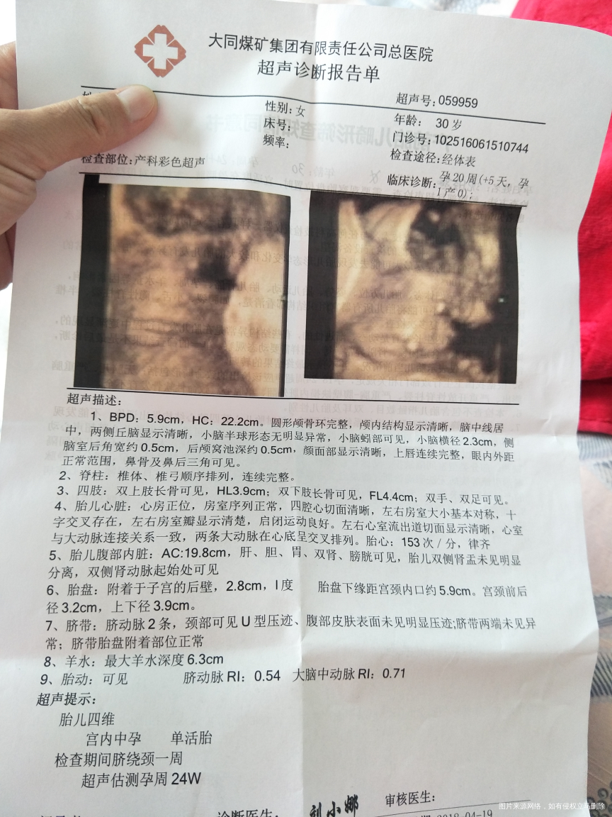 刚做的四维,单子拿到手请医生帮我看下