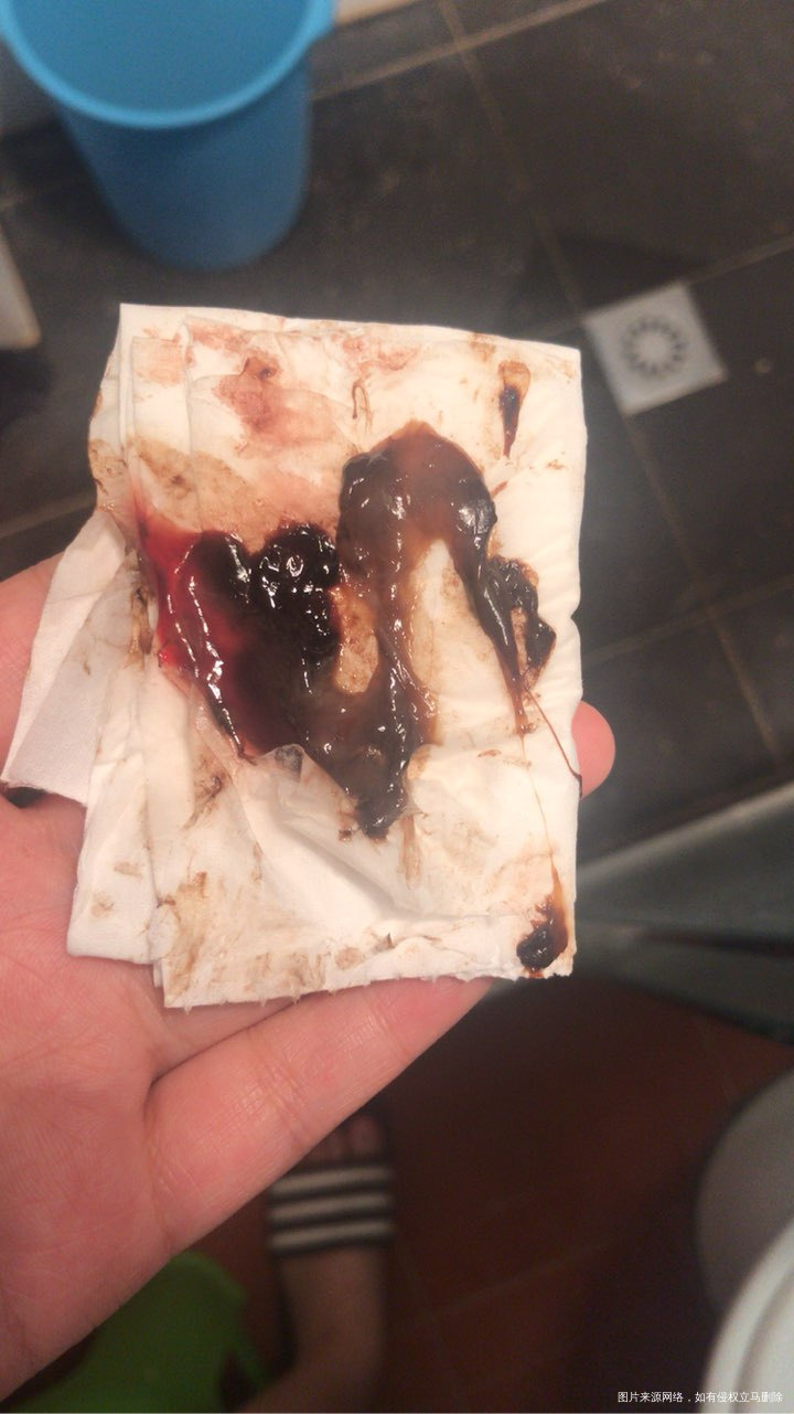 27周突然出血,做了彩超胎儿正常,第二天