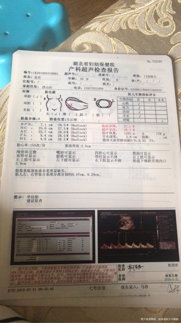 27周突然出血,做了彩超胎儿正常,第二天