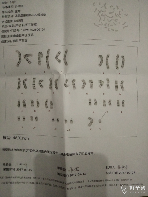 染色体报告麻烦医生看看