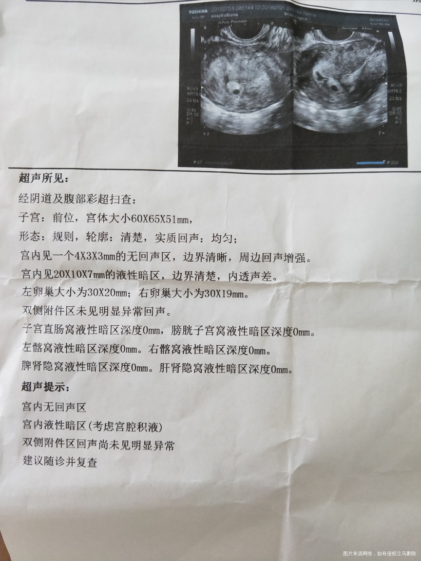 移植第二十八天,今天一超回来了