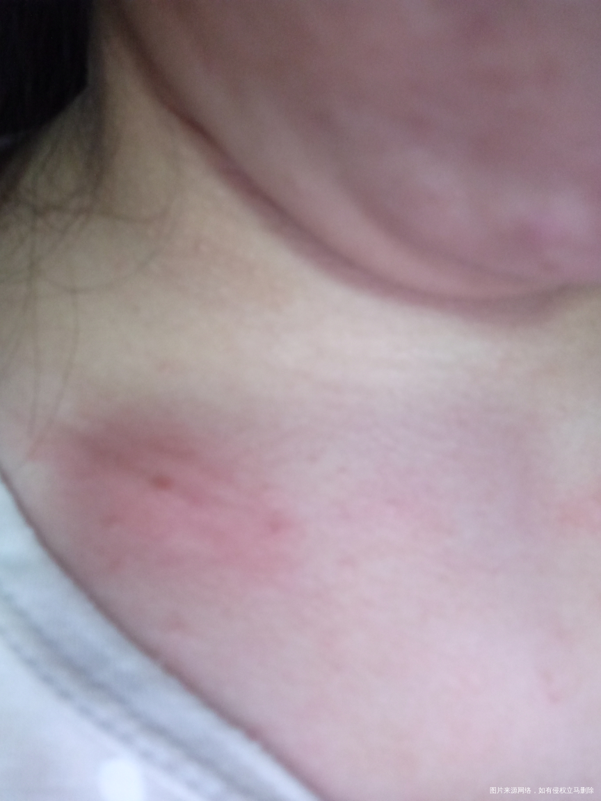 医生帮我看看这是怎么啦?因为怀孕了,有点担心。