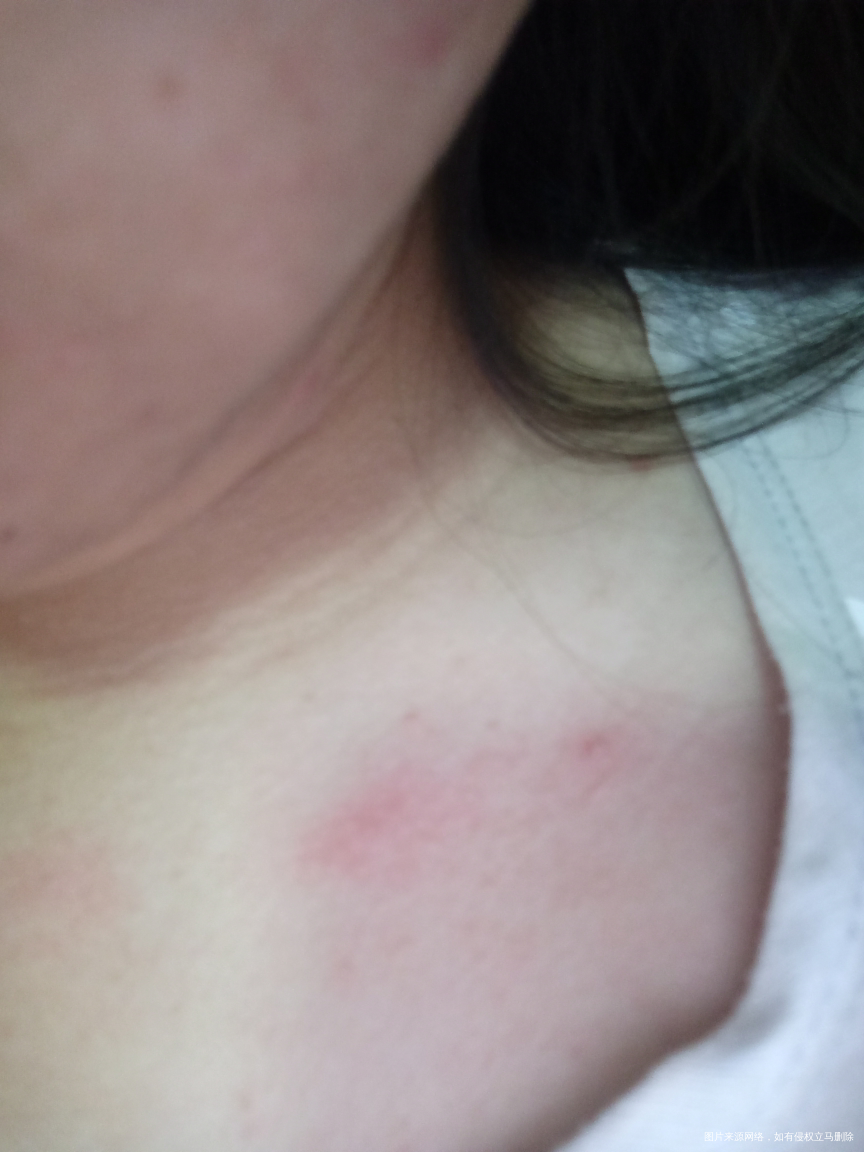 医生帮我看看这是怎么啦?因为怀孕了,有点担心。