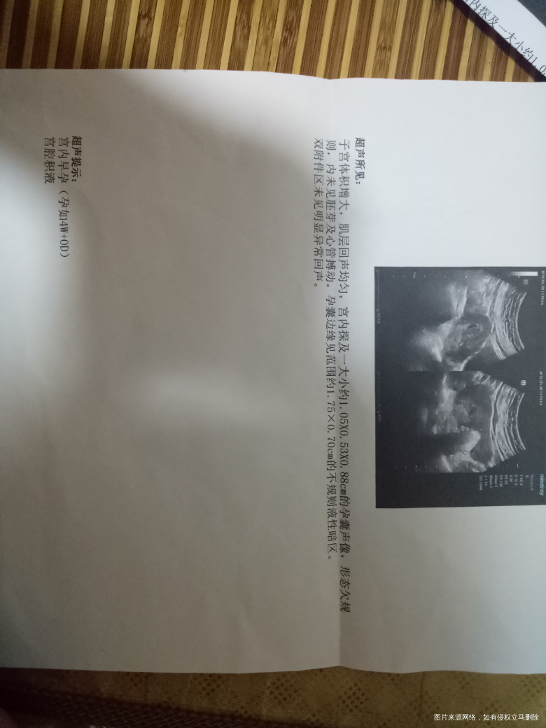 可以帮我看一下吗?这样的保胎意义大不大?