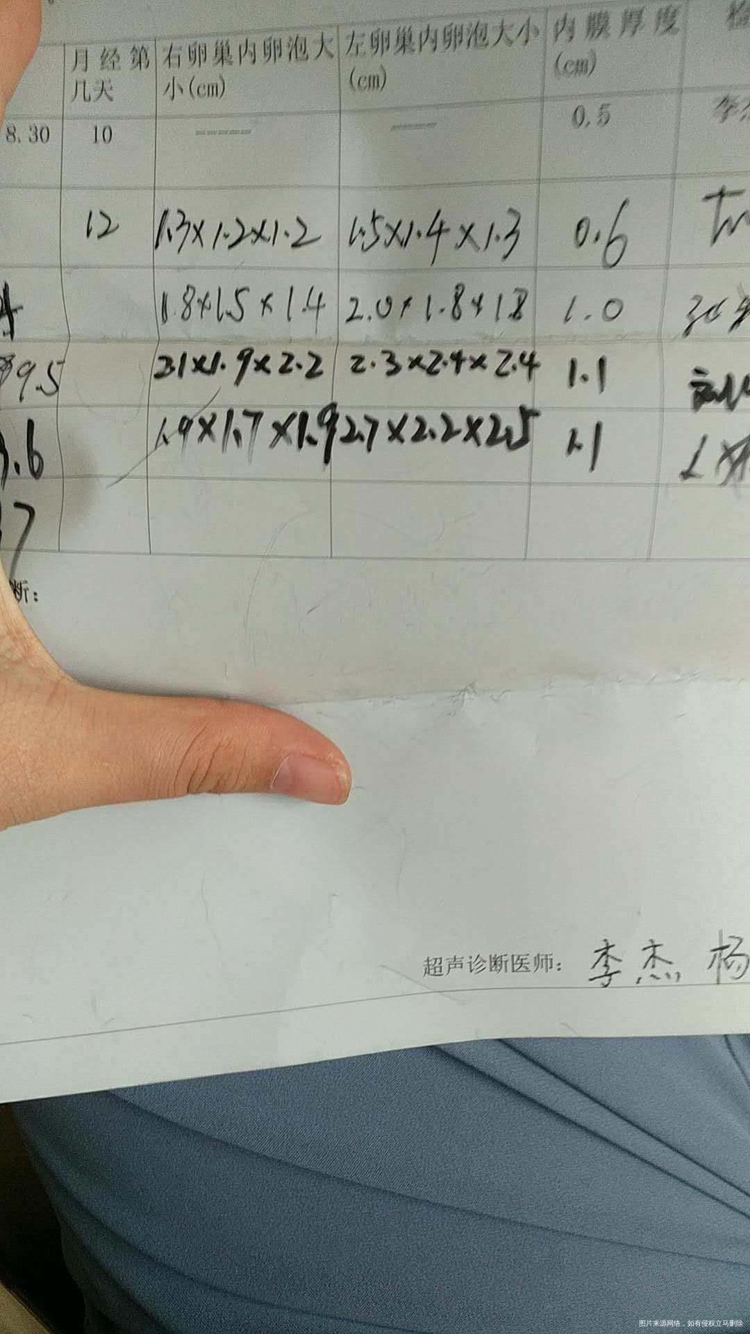 昨天测到两个优势卵泡,昨天下午打的破卵针!