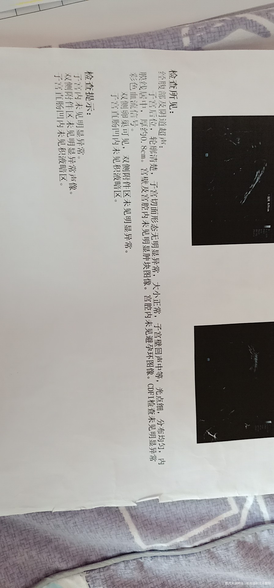 这是什么情况医生帮我看看分析分析