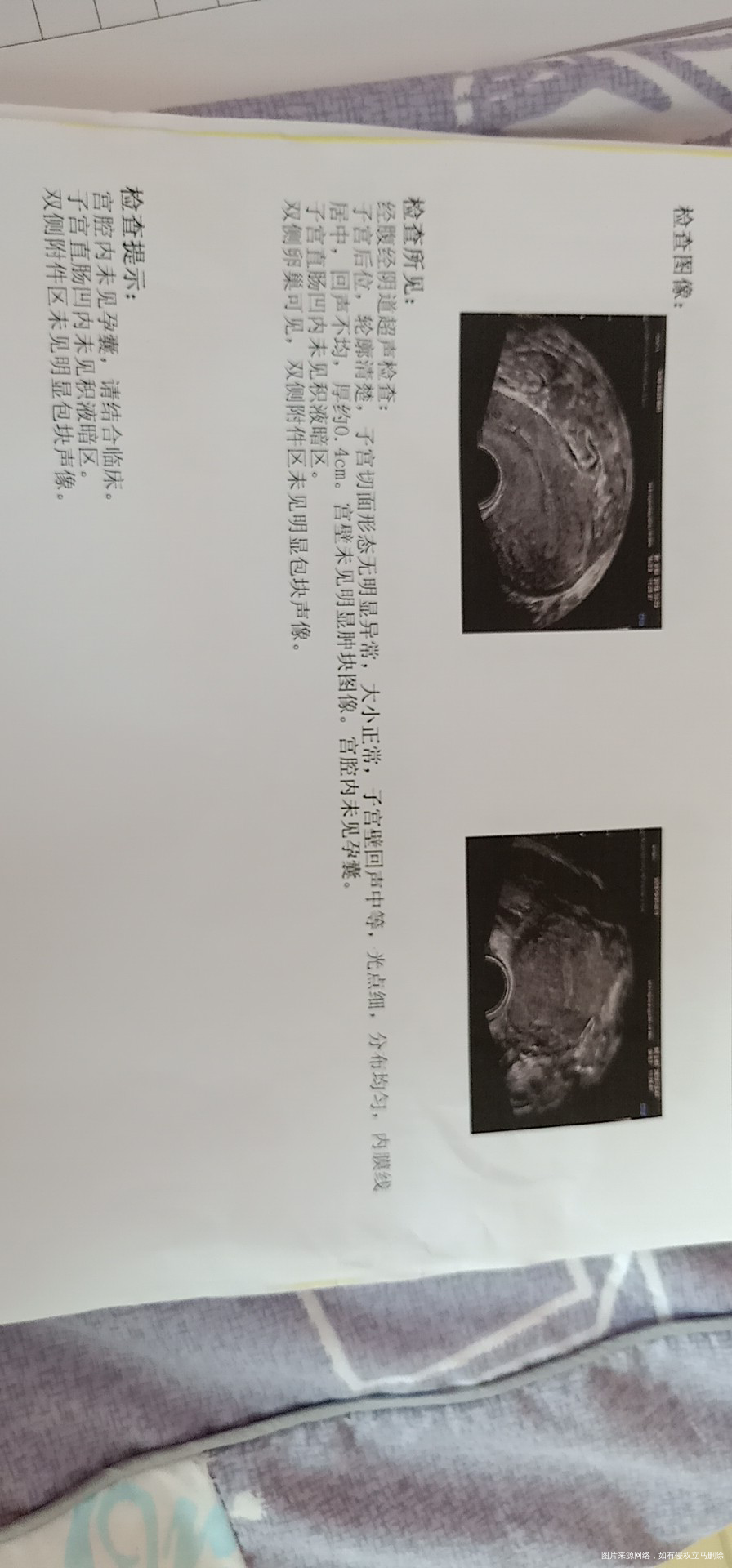 这是什么情况医生帮我看看分析分析