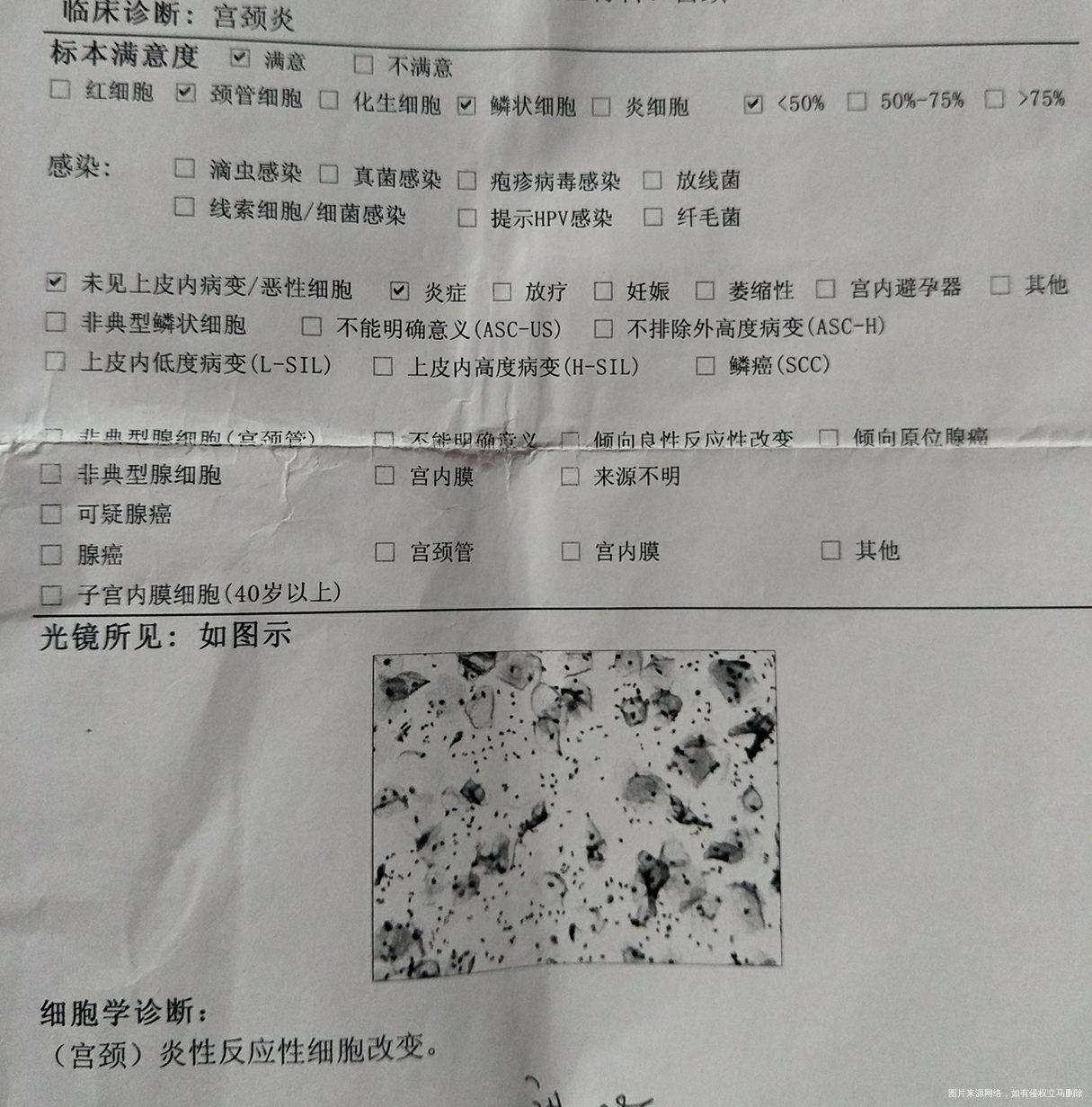 hpv52是阳性 解腺支原体也是阳性 能顺产吗什么时候能治疗